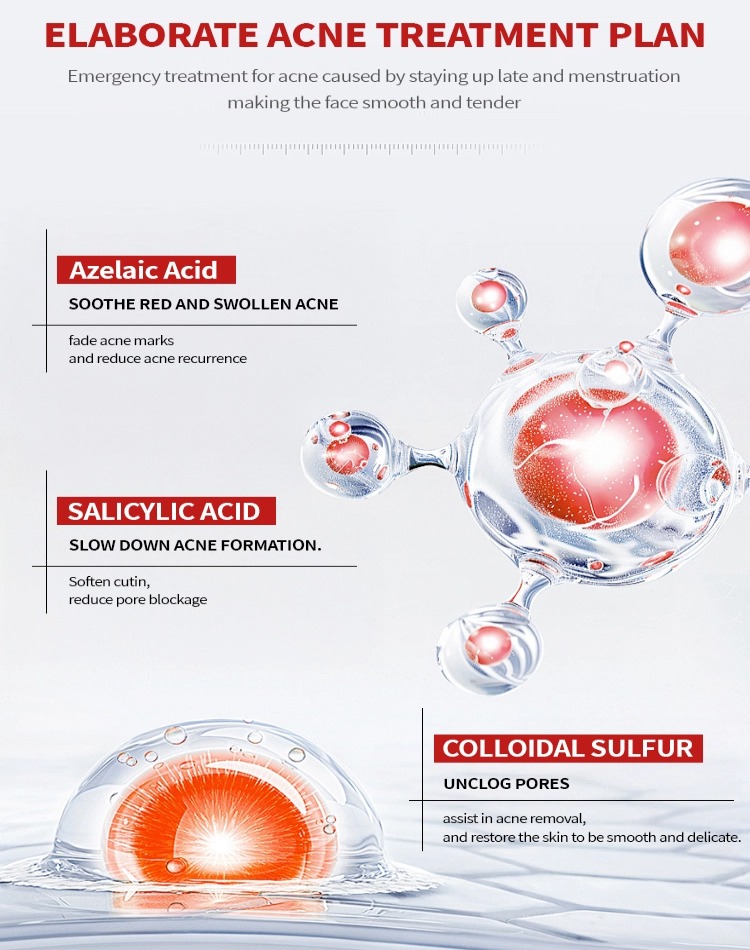 Acne Scar Fading Cream