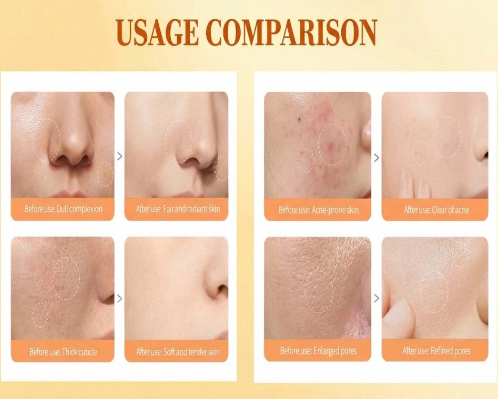 Turmeric Kojic Acid Skincare Set