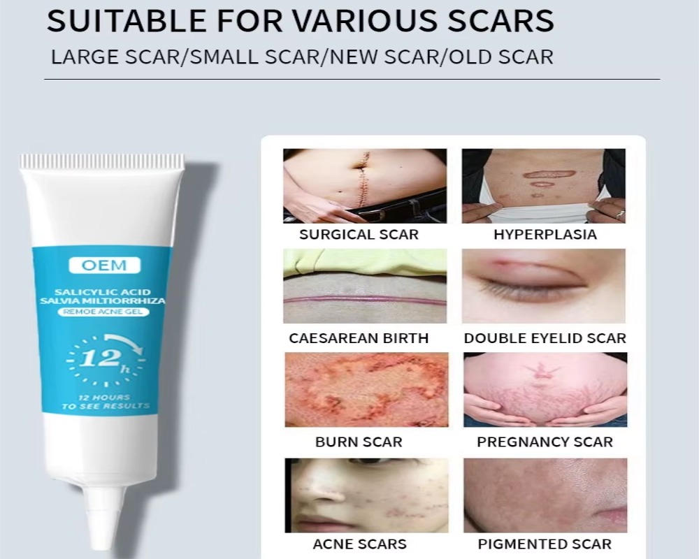salicylic acid kojic acid gel