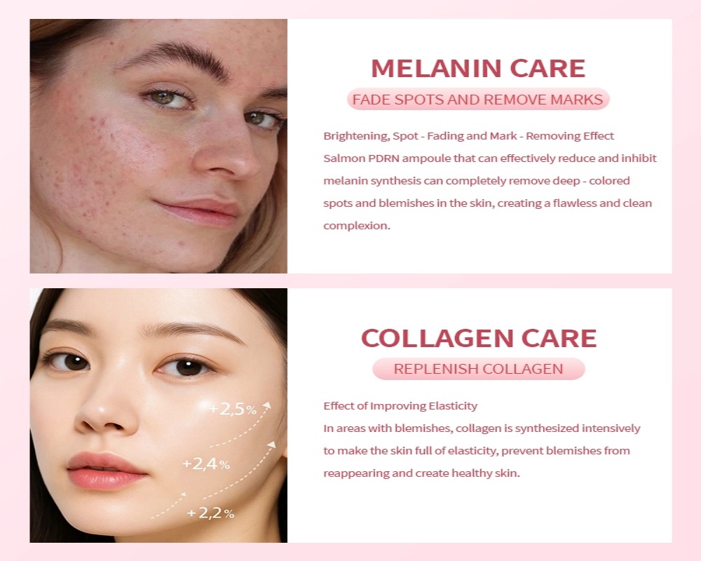 PDRN vs retinol for sensitive skin
