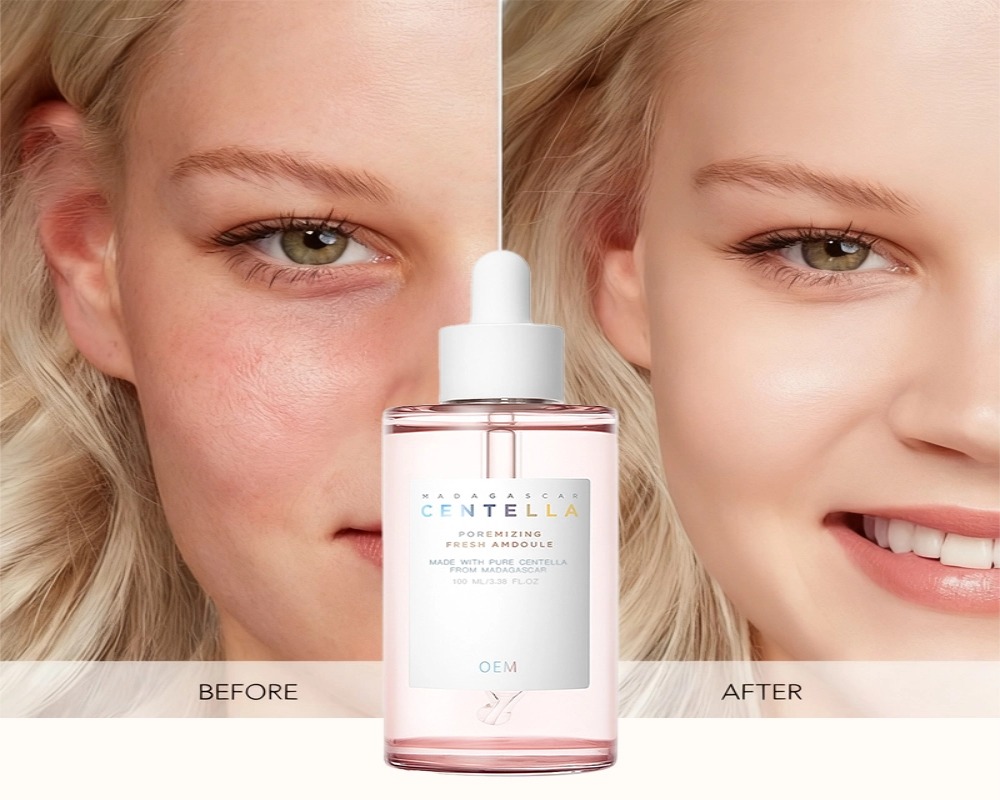 centella ampoule before after pore care