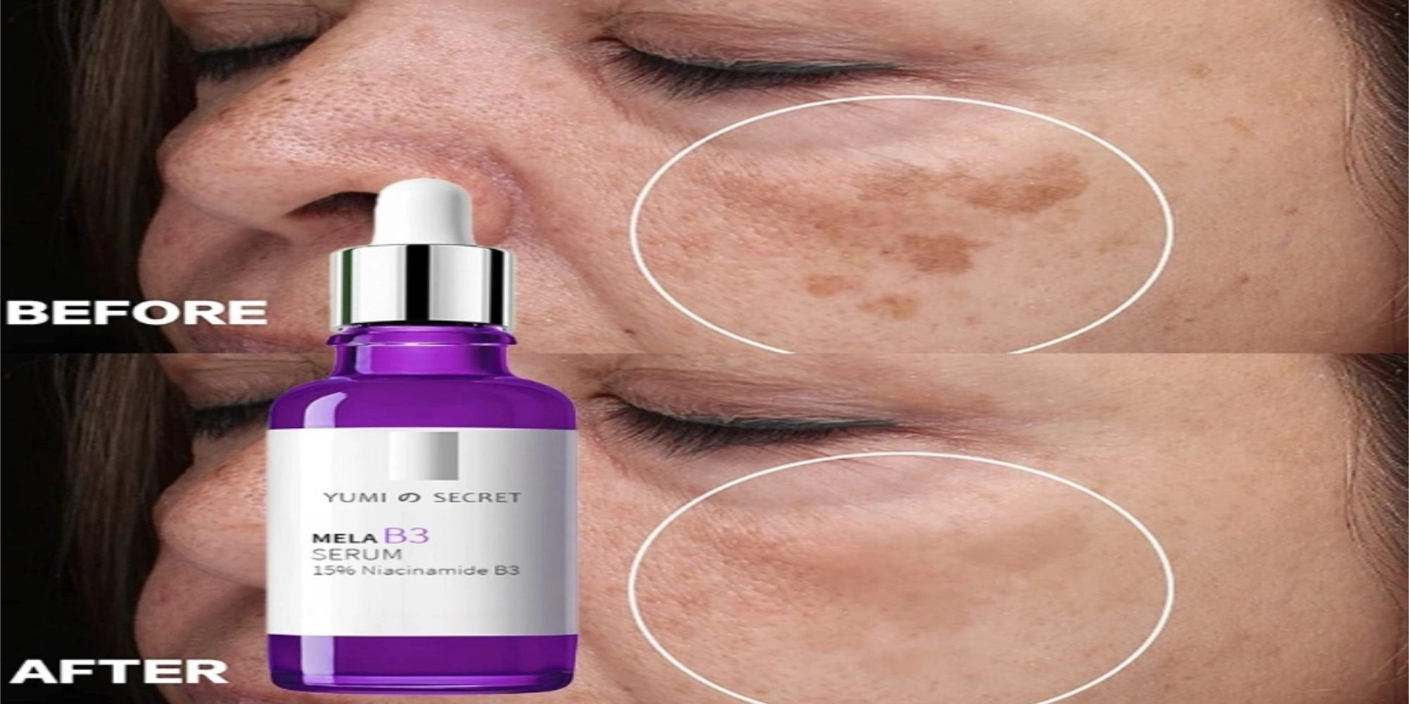 dark spot serum OEM
